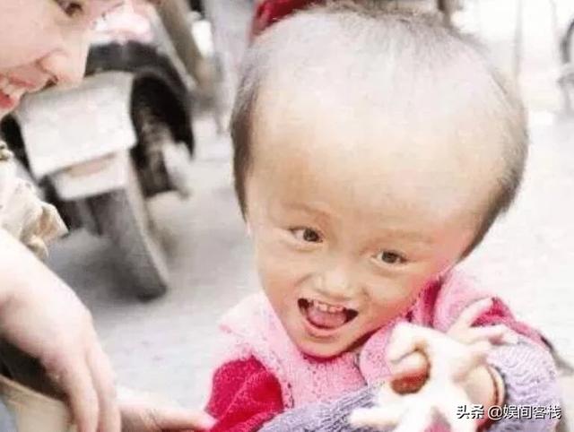 近日湖南多名嬰兒喝假奶粉成大頭娃娃引發關注商家為什么要這么做