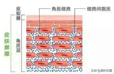 夏季皮肤问题图片:为什么一些人夏天皮肤过敏没冬天多？