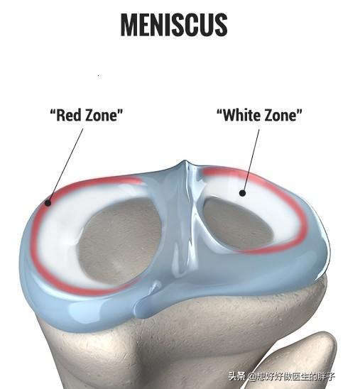 半月板损伤症状:半月板损伤症状有哪些 膝盖半月板损伤还能治好吗？
