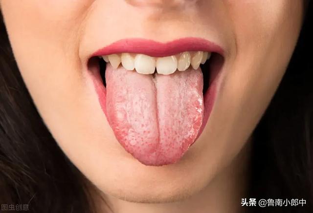 舌头胖大有齿痕，需要怎么调理？插图17