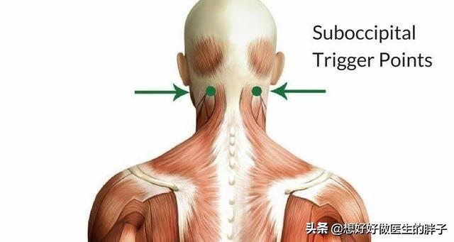 玛氏宠物护理学院限时挑战赛:颈椎病会引起头疼头晕吗？