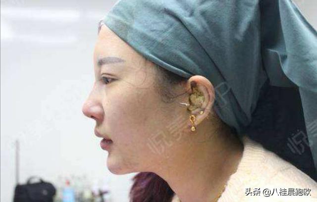 头条问答 有下巴和没下巴是什么意思 八桂晨跑欧 1951的回答 0赞