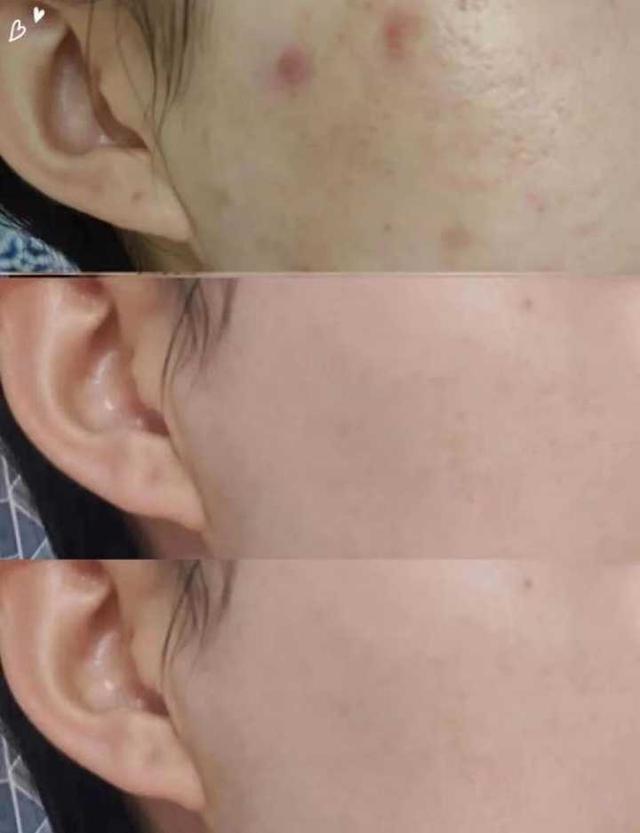 美白用什么好;有什么好的洗面奶或者面霜可以美白吗？