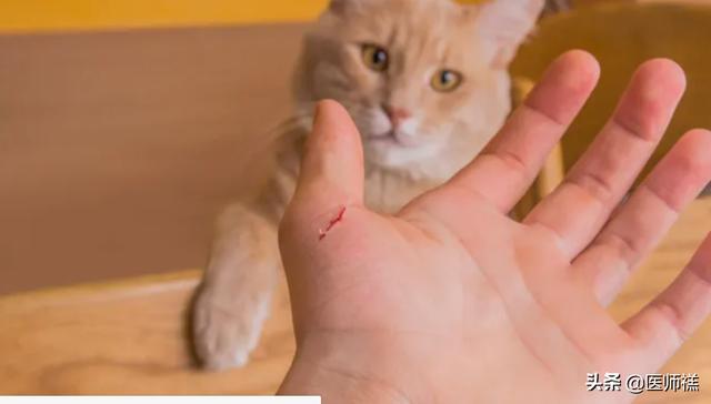 被猫抓伤多少天过危险期了:被猫抓超过3个月有狂犬病吗？