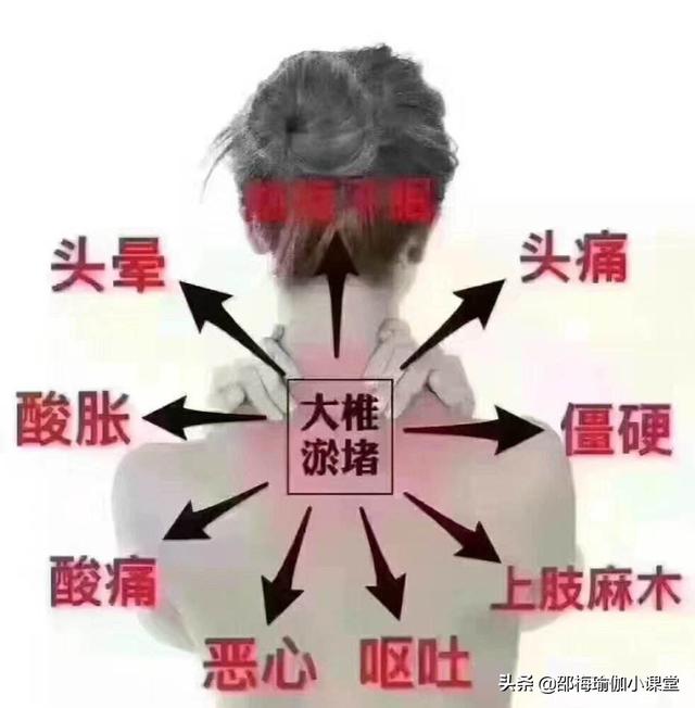 头条问答 - 颈肩综合征有什么锻炼方法?(13个回答)