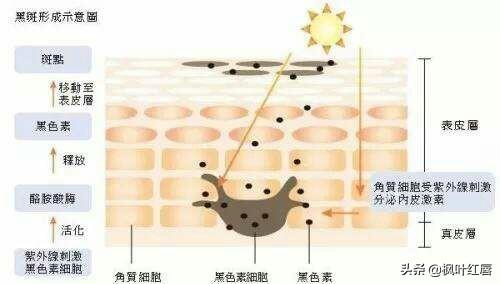 去角质对痘痘有用吗,男生用去角质凝胶效果怎么样？