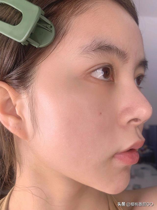 祛痘秘方(祛痘秘方配制)