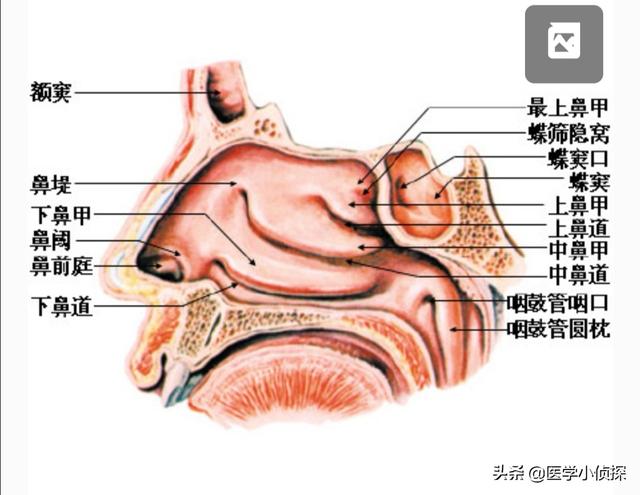 头条问答 为什么鼻炎都会在早晨一起床时鼻子发痒 打喷嚏严重 近中午就会好些 13个回答