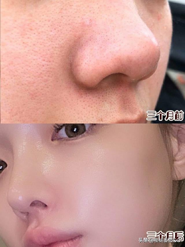 面部清洁:平时的脸部清洁工作你会花多少时间？