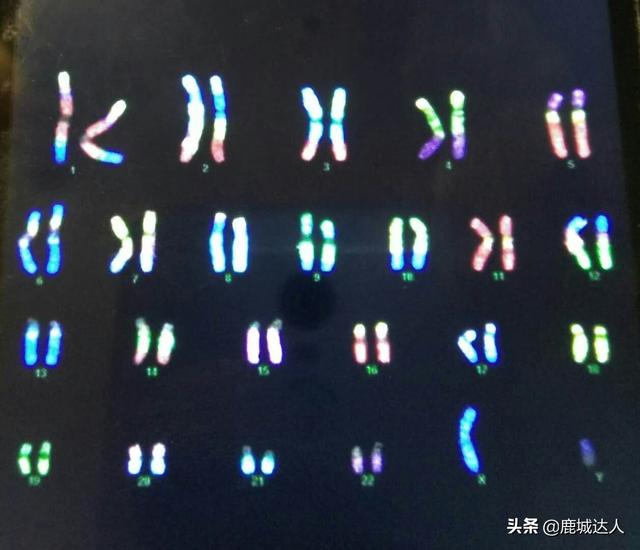 猫叫综合征:问一下人类的染色体有什么做用