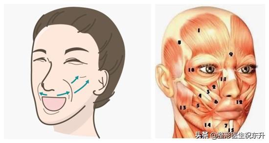 法令纹太深怎么办(法令纹太深如何解决)