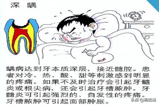 儿童补牙(儿童补牙一般多少钱一颗)