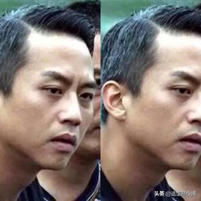 头条问答 40岁以内白头发增多 白发还能转黑吗 该怎么转 29个回答