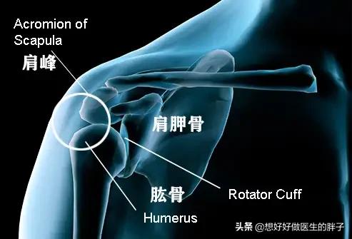 拔罐进风疼痛肩膀疼痛怎么办?肩膀拔罐拔出水泡是怎么回事