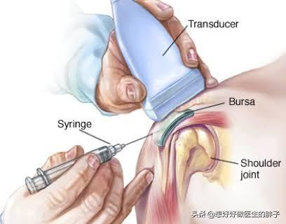 拔罐进风疼痛肩膀疼痛怎么办?肩膀拔罐拔出水泡是怎么回事