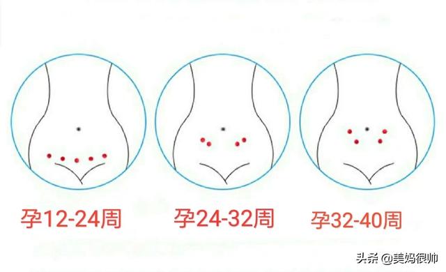 怀孕十八周多了,胎心率是170多,是什么原因呢？