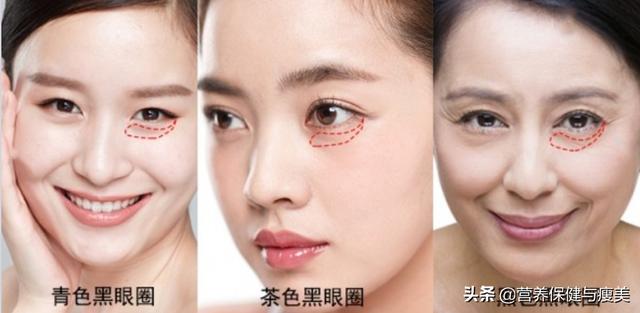 黑眼圈是怎样形成的:女人的黑眼圈是怎么形成的?