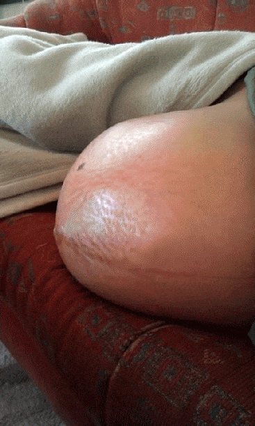 怀孕6个月，孕妇肚子突然一半硬一半软，是胎儿缺氧了吗？该怎么办？插图2