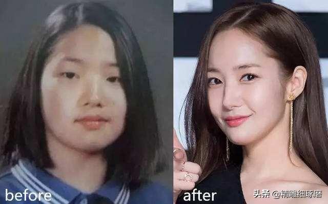 朴敏英整容:为什么朴敏英整了现在也很自然