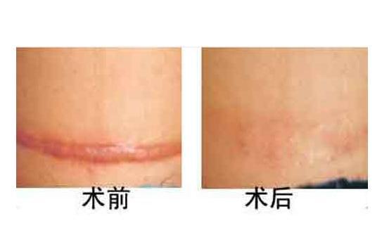 张梓琳腋下现疤痕:女朋友很漂亮也很有钱，但是身上一股怪味，闻到想吐，怎么办？