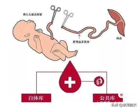 有必要给孩子保存脐带血吗