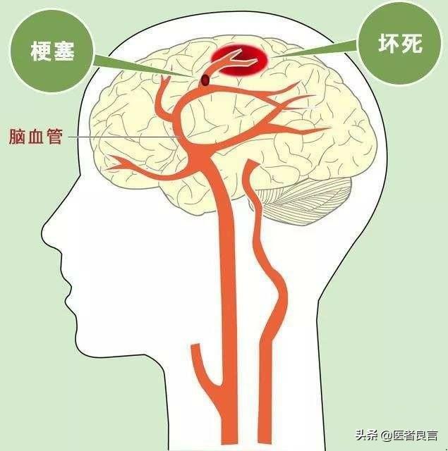 每天喝一杯白酒，对健康有害吗？插图28