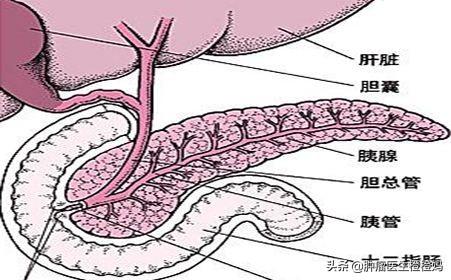 胰腺炎症状:胰腺癌一般是什么导致的？