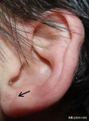 先天性心脏病的症状:先天性心脏病的症状有哪些呢 小儿先天性心脏病平时有什么反应？