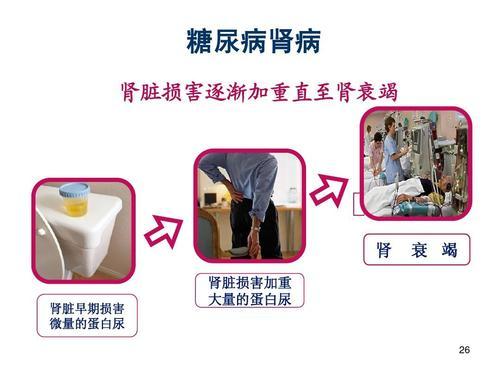 糖尿病尿毒症前兆:糖尿病与高血压会得尿毒症，是真的吗？