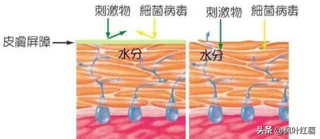 宝宝脸上过敏怎么办?宝宝脸上过敏起红疹怎么办