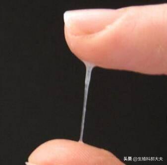 怎么备孕更容易成功？