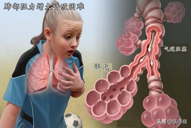 心肌缺血的早期症状,心脏病的早期症状是怎样的？