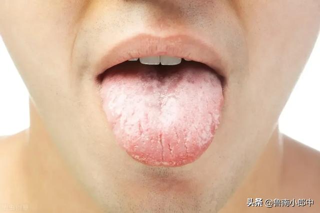 舌头胖大有齿痕，需要怎么调理？插图16