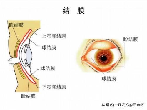 一个月婴儿角膜炎症状图片:宝宝26个月，结膜炎一直反反复复好不了怎么办？
