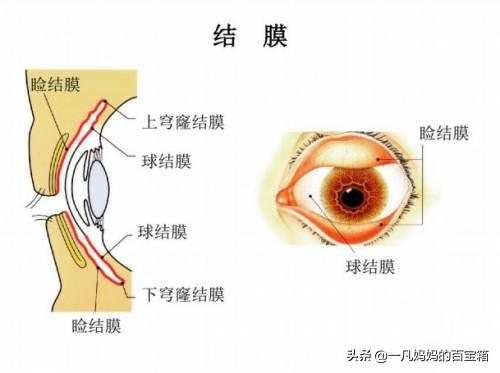 结膜炎怎么办:结膜炎不让上飞机怎么办？