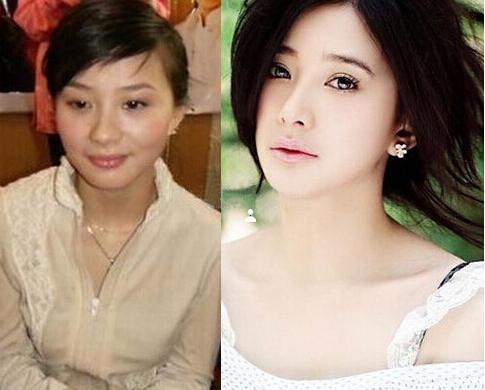 贾青整容:整容最成功的女明星是谁？