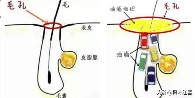 bb霜和素颜霜的区别,17岁适合用素颜霜还是bb霜？