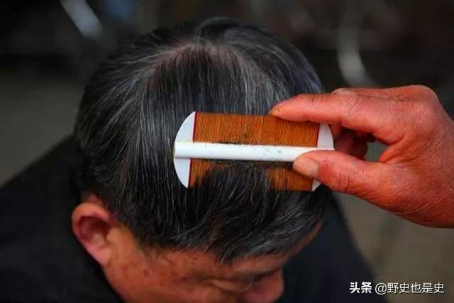 医院皮肤科可以看头虱吗:七八十年代人身上的虱子是怎么来的？