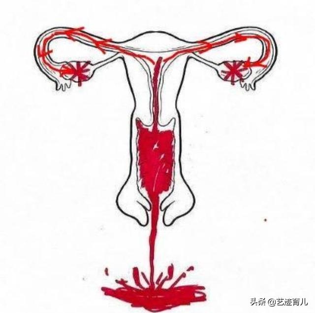 作为孕妇,该怎样去预防羊水栓塞的发生？