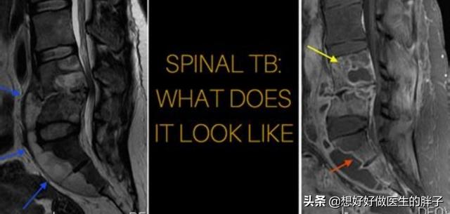 犬虫一扫光一吃就吐:医生表示：当头上被螨虫撕咬，会频繁出现4个现象！是哪些呢？