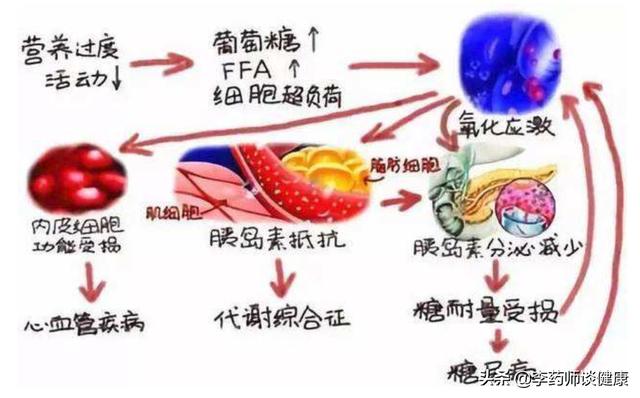 2型糖尿病的症状:2型糖尿病的症状有哪些 二型糖尿病是因为糖吃多了引起的吗？