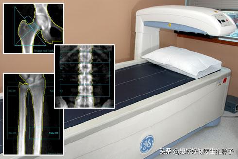 手部增生性关节炎怎么治:指关节胀痛僵硬暗示什么疾病？ 手关节增生性关节炎怎么治疗