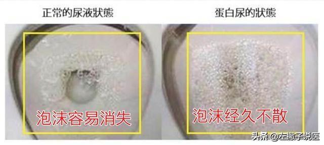 萌狗俊介尿液有泡沫:宠物养护俊介流鼻涕拉稀怎么办 小便中带泡沫是泌尿系统出了什么问题？
