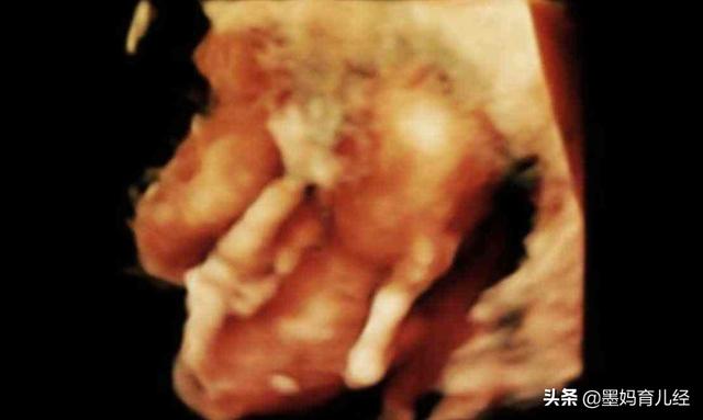 头条问答 怀孕16周多了还没有胎动 早孕反应也消失了 这种症状正常吗 6个回答