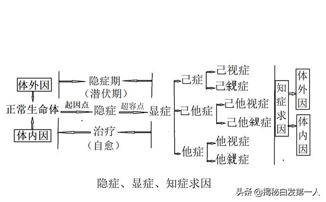 肺炎真菌感染的症状:真菌感染引起的肺炎症状 平时除了感冒会引发肺炎，其他诱发肺炎的症状还有哪些？