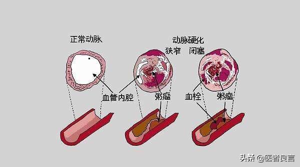 养护肝脏喝什么茶好,养肝养胃应该泡些什么食材喝呢？