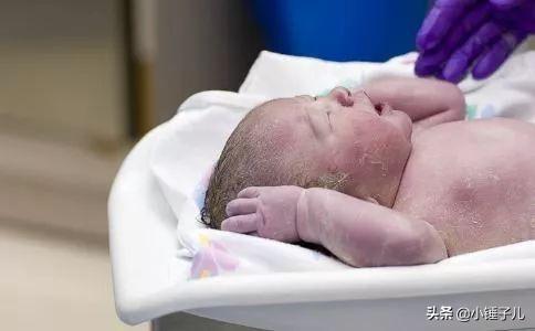 新生儿脱皮有哪两种原因，婴儿连续几次脱皮是怎么回事