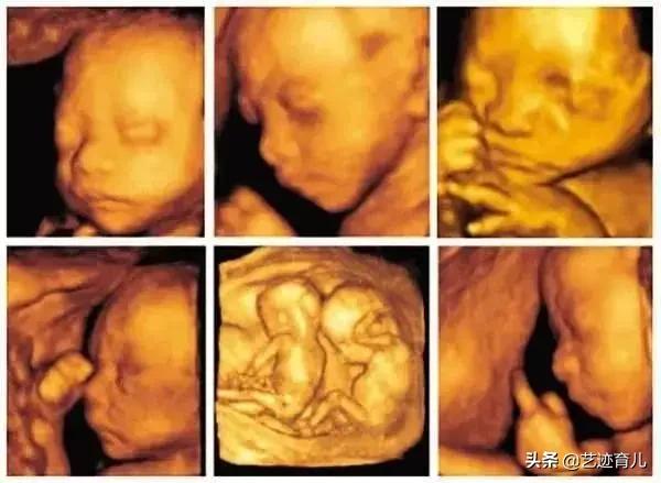 胎儿缺氧的表现有哪些，当胎儿缺氧，往往有哪些临床表现