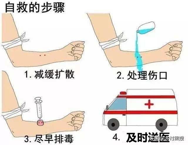 无毒蛇咬人吗:蛇咬人是出于一种什么心理？