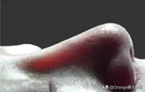 张檬整容记图片:为什么现在的女孩，已经长得很漂亮了还去整容？